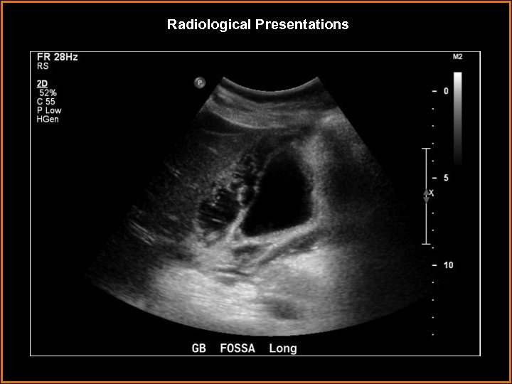 Radiological Presentations 