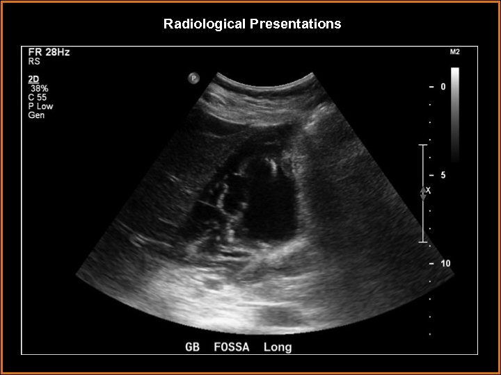 Radiological Presentations 