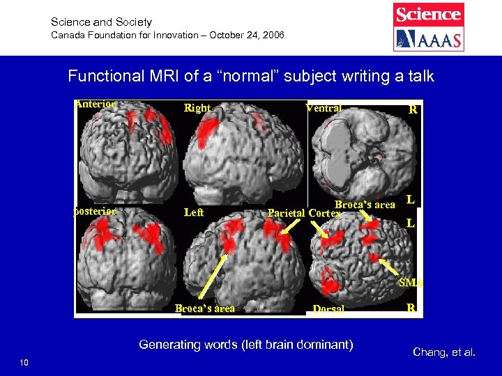 Science and Society Canada Foundation for Innovation – October 24, 2006 Functional MRI of