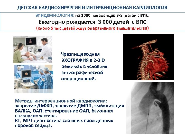 ДЕТСКАЯ КАРДИОХИРУРГИЯ И ИНТЕРВЕНЦИОННАЯ КАРДИОЛОГИЯ ЭПИДЕМИОЛОГИЯ: на 1000 младенцев 6 -8 детей с ВПС.