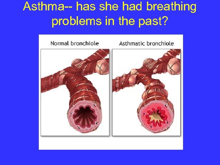 Asthma-- has she had breathing problems in the past? 