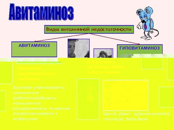 Виды витаминной недостаточности АВИТАМИНОЗ Отсутствие в организме какоголибо витамина Цинга, рахит, куриная слепота, пеллагра,