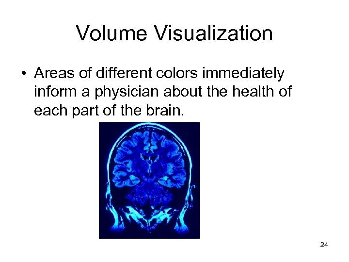 Volume Visualization • Areas of different colors immediately inform a physician about the health