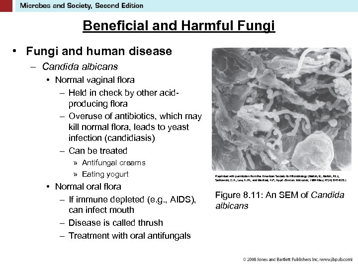 Beneficial and Harmful Fungi • Fungi and human disease – Candida albicans • Normal