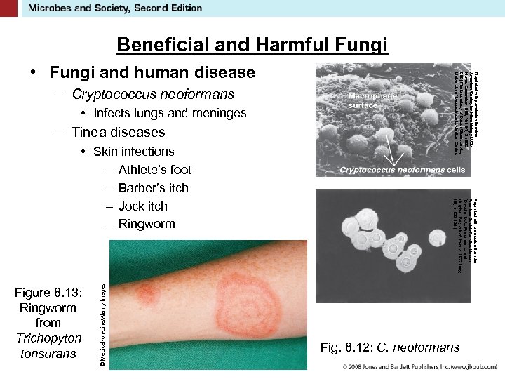 – Cryptococcus neoformans • Infects lungs and meninges – Tinea diseases Reprinted with permission