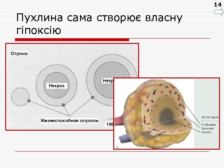 14 Пухлина сама створює власну гіпоксію 