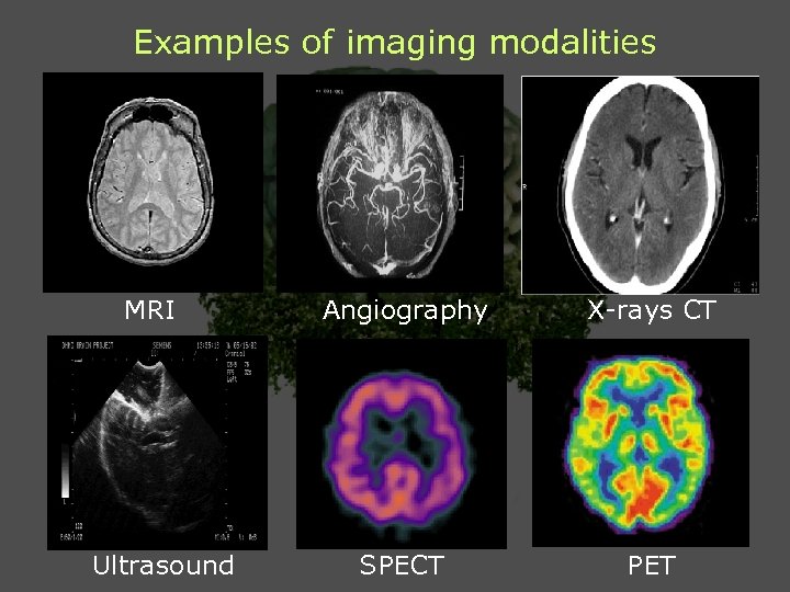 Examples of imaging modalities MRI Ultrasound Angiography X-rays CT SPECT PET 