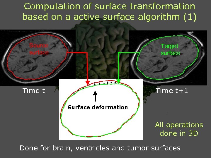 Computation of surface transformation based on a active surface algorithm (1) Source surface Target