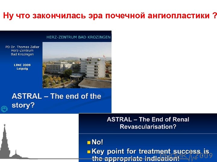 Ну что закончилась эра почечной ангиопластики ? 