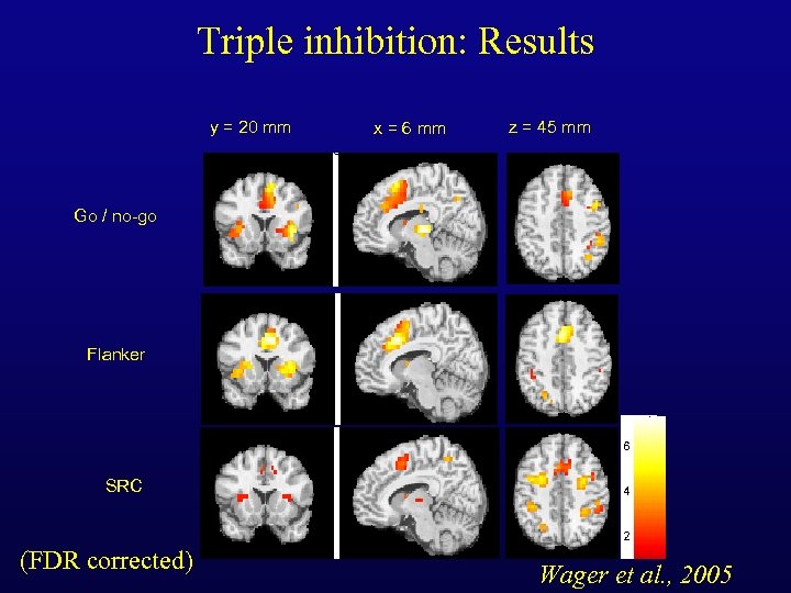 Triple inhibition: Results y = 20 mm x = 6 mm z = 45