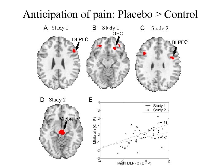Anticipation of pain: Placebo > Control A Study 1 B Study 1 OFC C