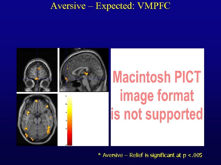 Aversive – Expected: VMPFC * Aversive – Relief is significant at p <. 005