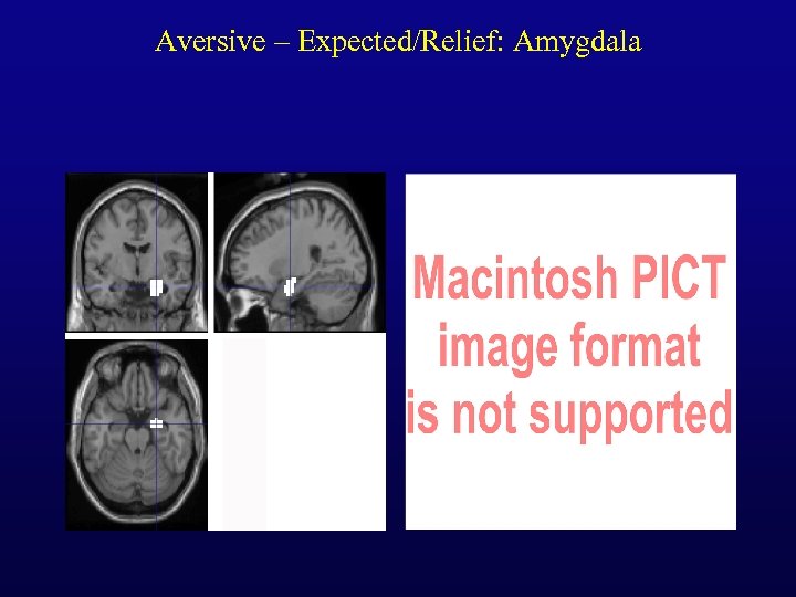 Aversive – Expected/Relief: Amygdala 