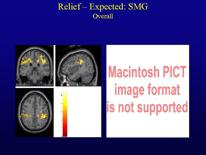 Relief – Expected: SMG Overall 