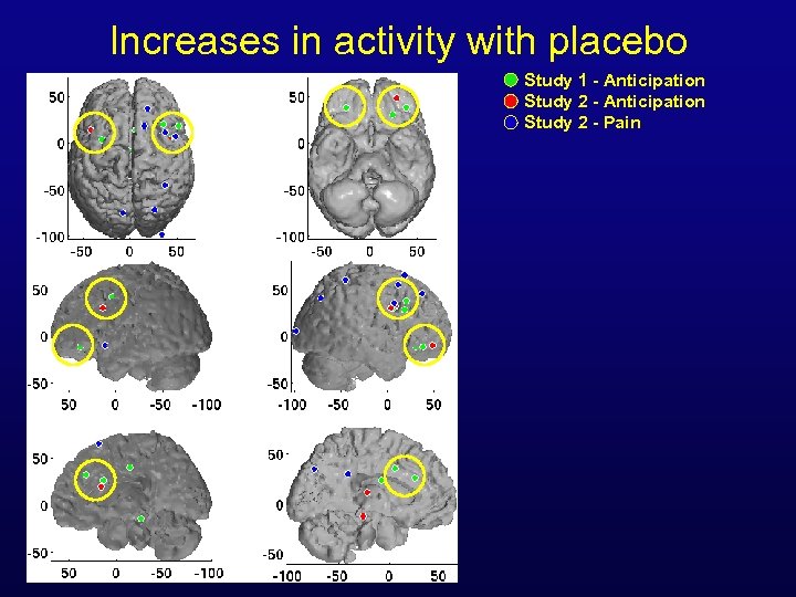 Increases in activity with placebo Study 1 - Anticipation Study 2 - Pain 