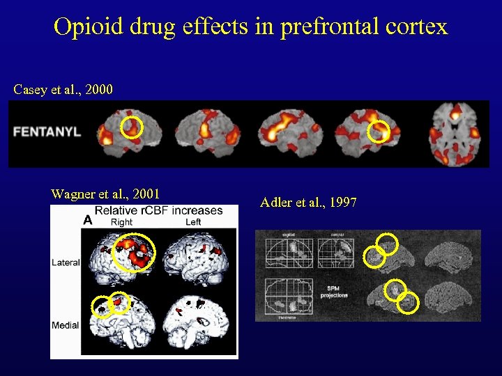 Opioid drug effects in prefrontal cortex Casey et al. , 2000 Wagner et al.