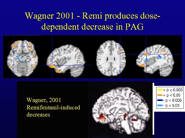 Wagner 2001 - Remi produces dosedependent decrease in PAG Wagner, 2001 Remifentanil-induced decreases 
