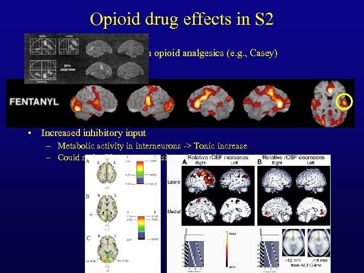Opioid drug effects in S 2 • Increases in S 2 with verum opioid