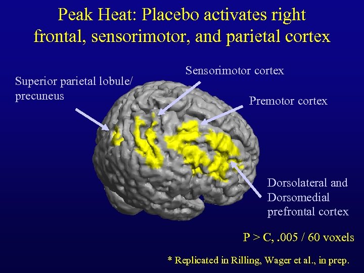 Peak Heat: Placebo activates right frontal, sensorimotor, and parietal cortex Superior parietal lobule/ precuneus