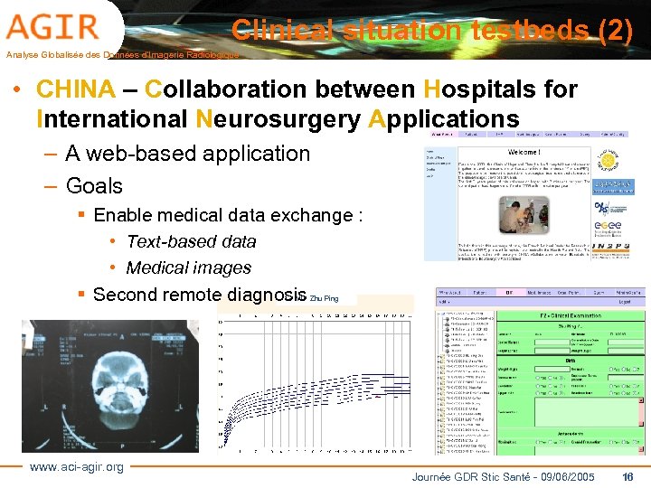 Clinical situation testbeds (2) Analyse Globalisée des Données d’Imagerie Radiologique • CHINA – Collaboration