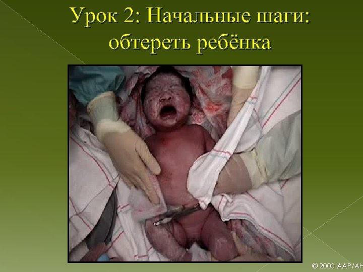 Урок 2: Начальные шаги: обтереть ребёнка © 2000 AAP/AH 