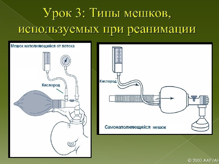 Урок 3: Типы мешков, используемых при реанимации B © 2000 AAP/AH 