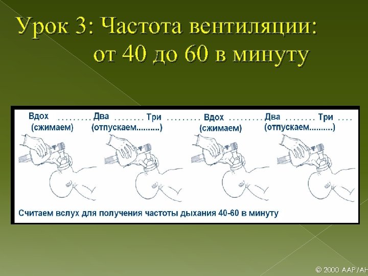 Урок 3: Частота вентиляции: от 40 до 60 в минуту © 2000 AAP/AH 