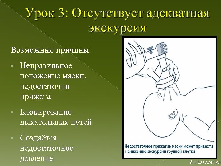 Урок 3: Отсутствует адекватная экскурсия Возможные причины • Неправильное положение маски, недостаточно прижата •