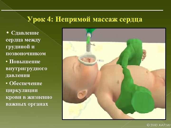 Урок 4: Непрямой массаж сердца • Сдавление сердца между грудиной и позвоночником • Повышение