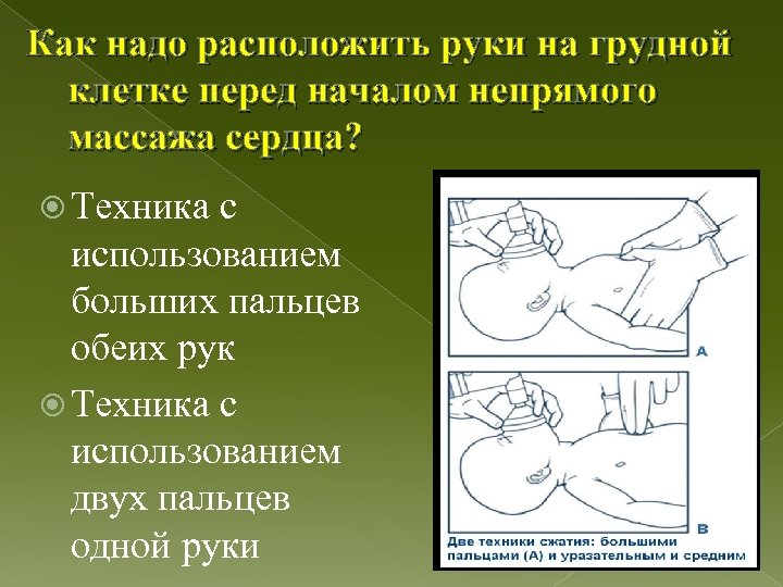 Как надо расположить руки на грудной клетке перед началом непрямого массажа сердца? Техника с