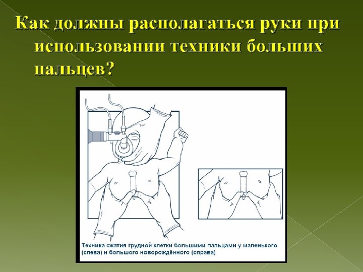 Как должны располагаться руки при использовании техники больших пальцев? 