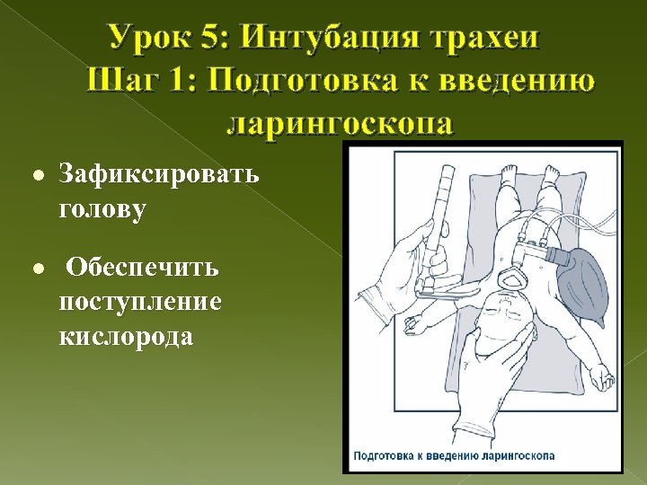 Урок 5: Интубация трахеи Шаг 1: Подготовка к введению ларингоскопа l Зафиксировать голову l