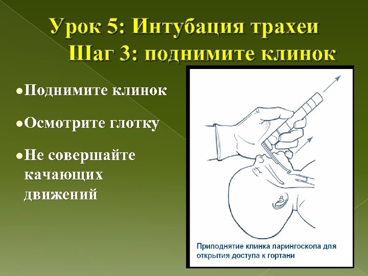 Урок 5: Интубация трахеи Шаг 3: поднимите клинок l Поднимите клинок l Осмотрите глотку