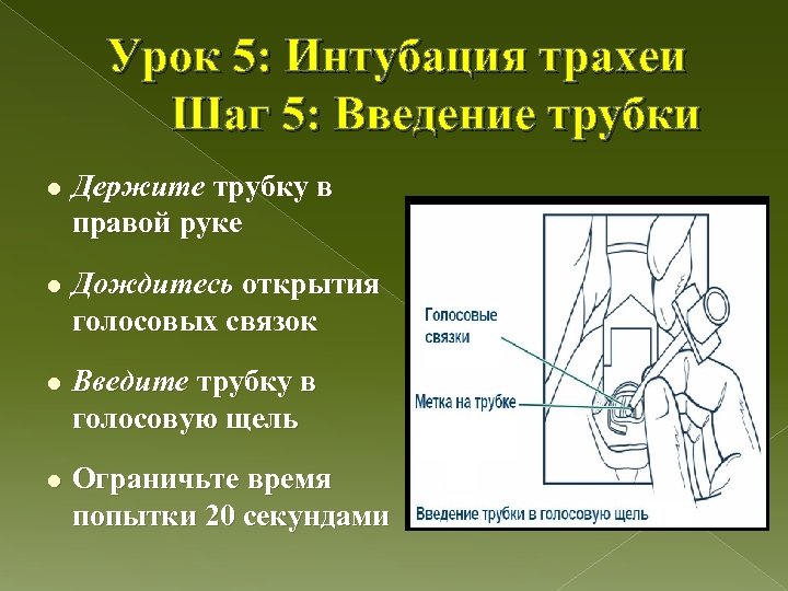Урок 5: Интубация трахеи Шаг 5: Введение трубки l Держите трубку в правой руке