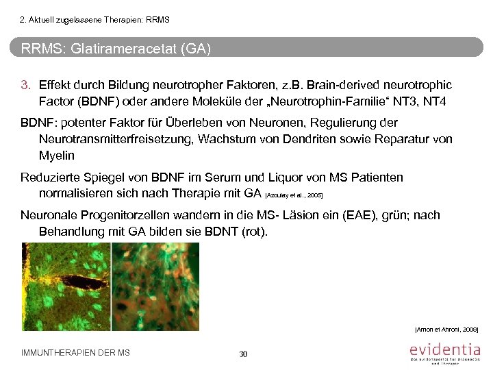 2. Aktuell zugelassene Therapien: RRMS: Glatirameracetat (GA) 3. Effekt durch Bildung neurotropher Faktoren, z.