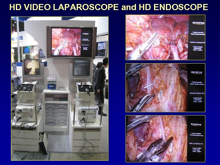 HD VIDEO LAPAROSCOPE and HD ENDOSCOPE 