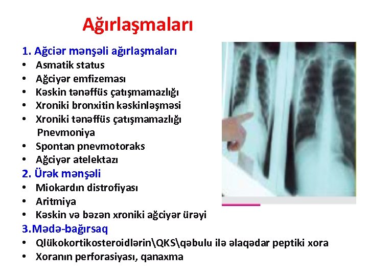 Ağırlaşmaları 1. Ağciər mənşəli ağırlaşmaları • Asmatik status • Ağciyər emfizeması • Kəskin tənəffüs
