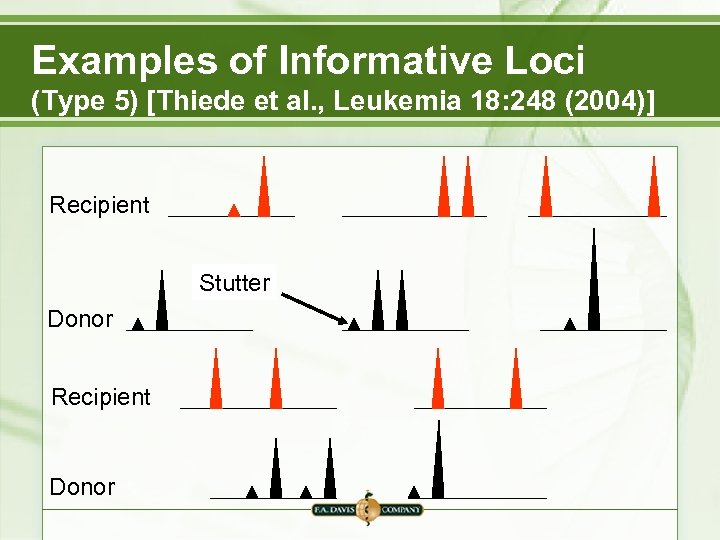 Examples of Informative Loci (Type 5) [Thiede et al. , Leukemia 18: 248 (2004)]
