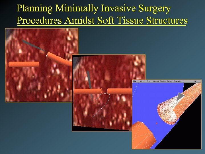 Planning Minimally Invasive Surgery Procedures Amidst Soft Tissue Structures 