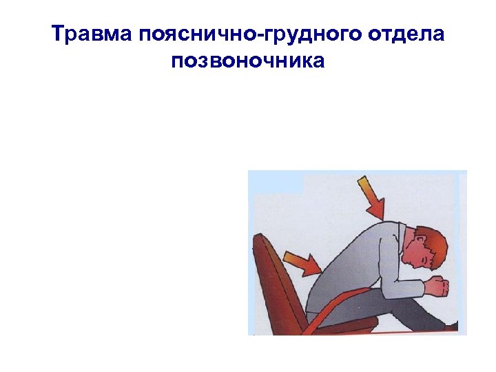 Травма пояснично-грудного отдела позвоночника 