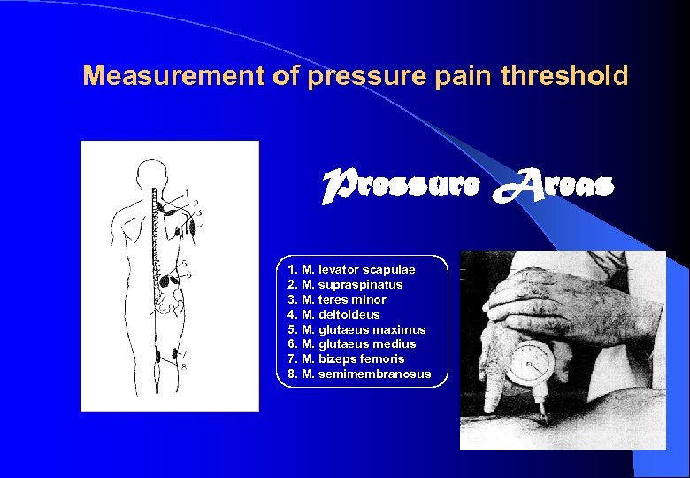 Measurement of pressure pain threshold Pressure Areas 1. M. levator scapulae 2. M. supraspinatus