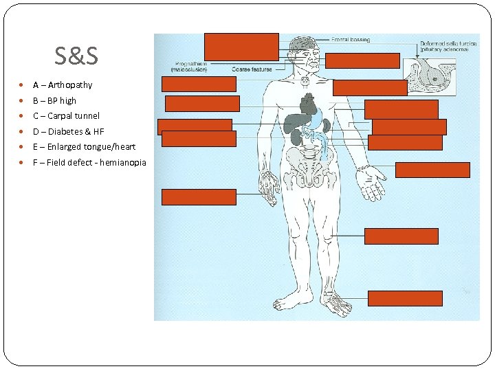 S&S A – Arthopathy B – BP high C – Carpal tunnel D –