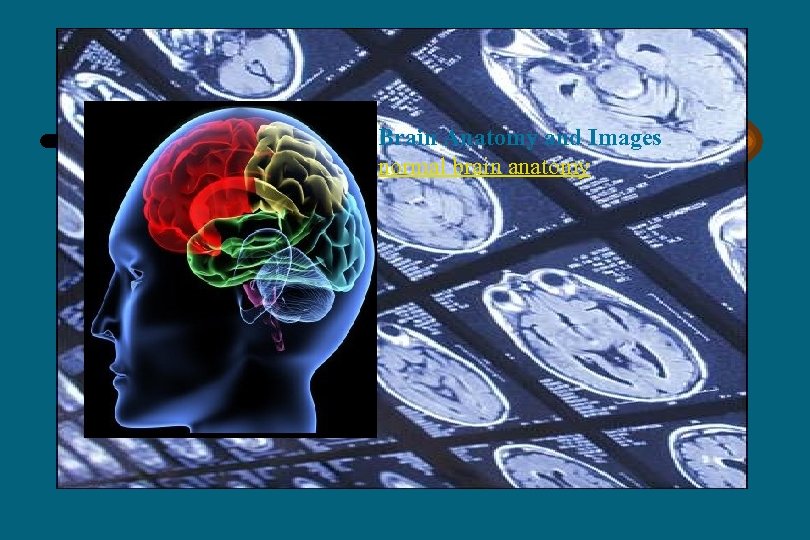 Brain Anatomy and Images normal brain anatomy 