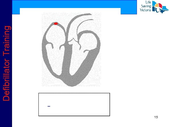 15 Defibrillator Training 