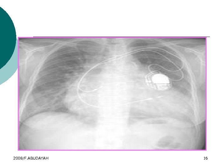 2008/F. ABUDAYAH 16 