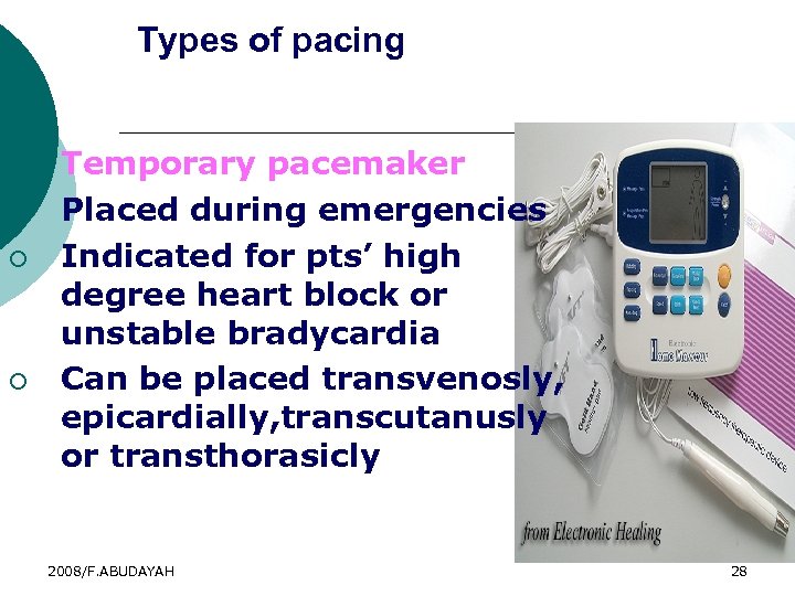 Types of pacing 2. ¡ ¡ ¡ Temporary pacemaker Placed during emergencies Indicated for
