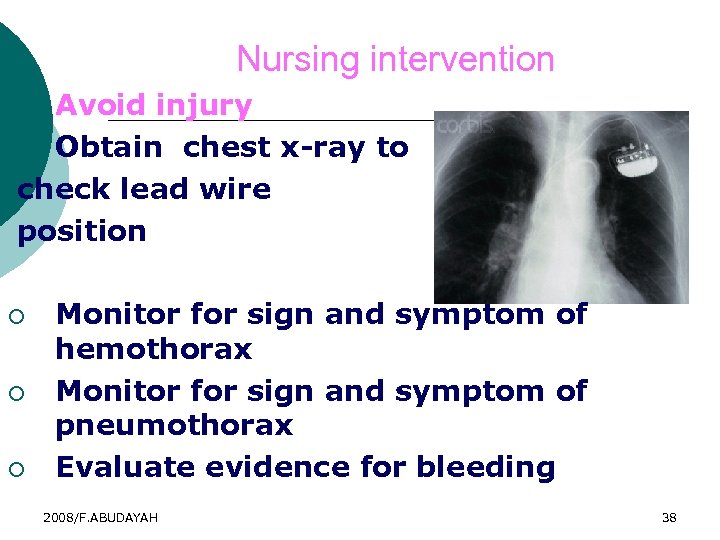 Nursing intervention Avoid injury ¡ Obtain chest x-ray to check lead wire position 2.