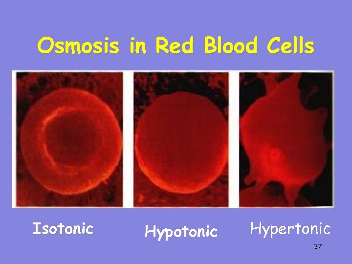 Osmosis in Red Blood Cells Isotonic Hypertonic 37 