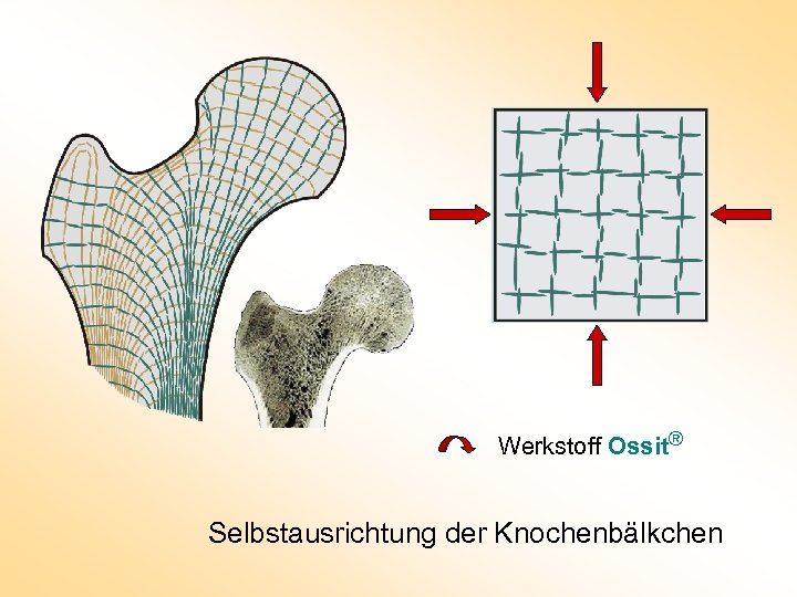 Werkstoff Ossit® Selbstausrichtung der Knochenbälkchen 