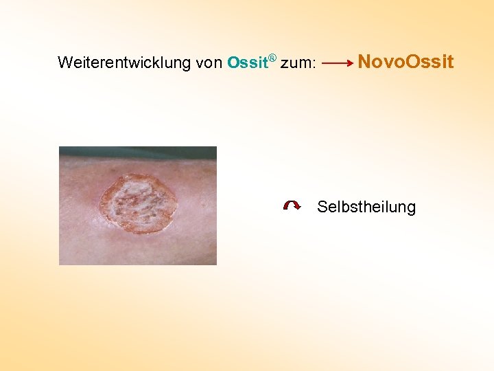 Weiterentwicklung von Ossit® zum: Novo. Ossit Selbstheilung 